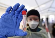 Coronavirus testing capacity in Pakistan drops by 56%