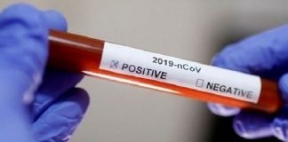 Balochistan’s active coronavirus cases drops to 213 COVID-19 - The News Today-TNT