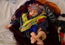 Pneumonia kills around 7500 children under 5 in Sindh child - The News Today - TNT